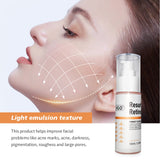 Skin transformation from retinol use