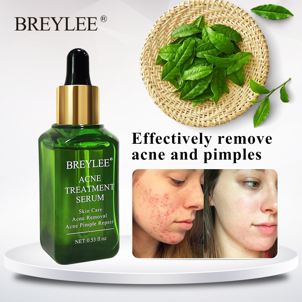 BREYLEE serum applied on cheek acne