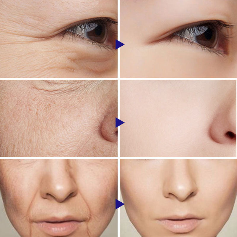 Wrinkle-reducing vitamin C serum