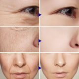 Wrinkle-reducing vitamin C serum