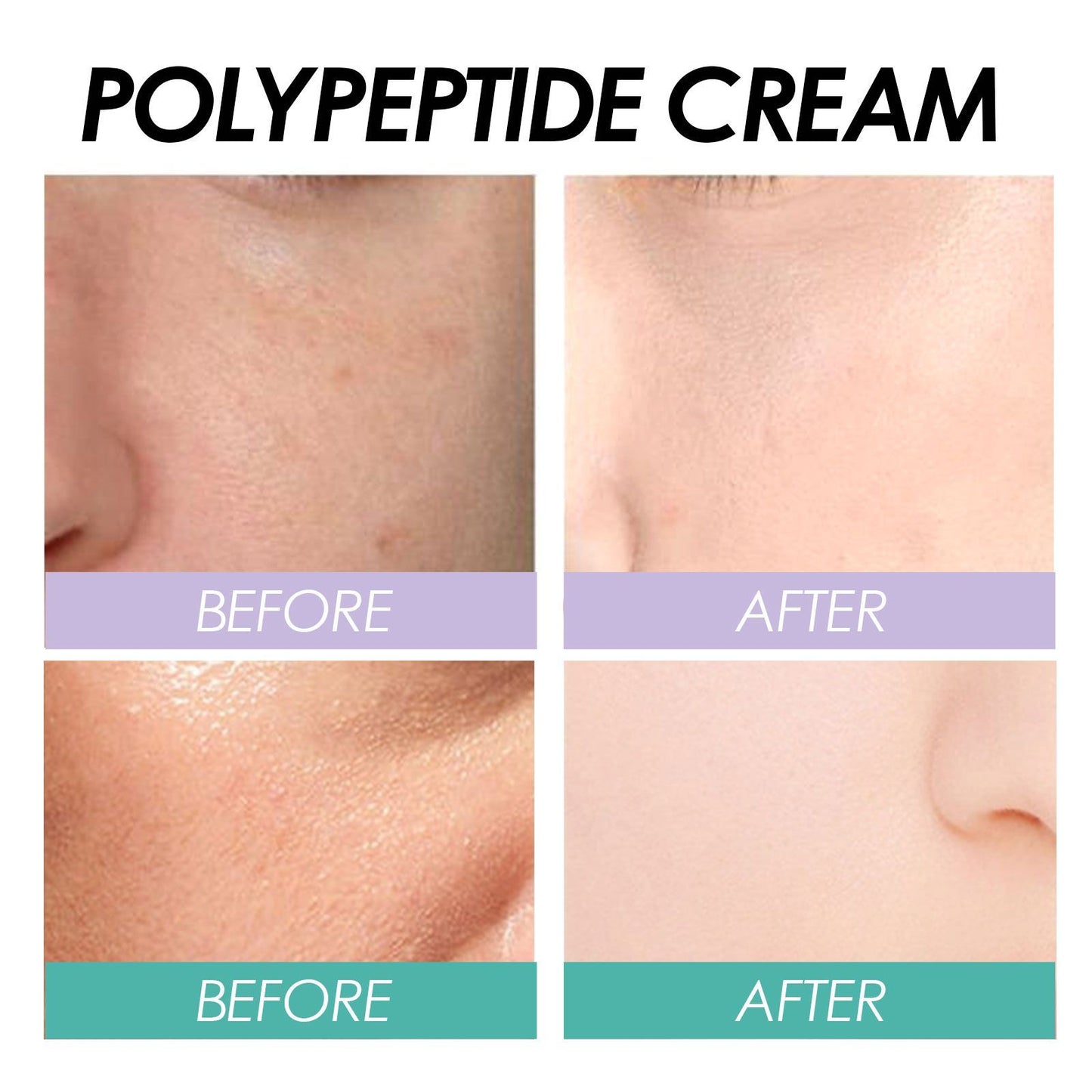 EELHOE cream before and after results