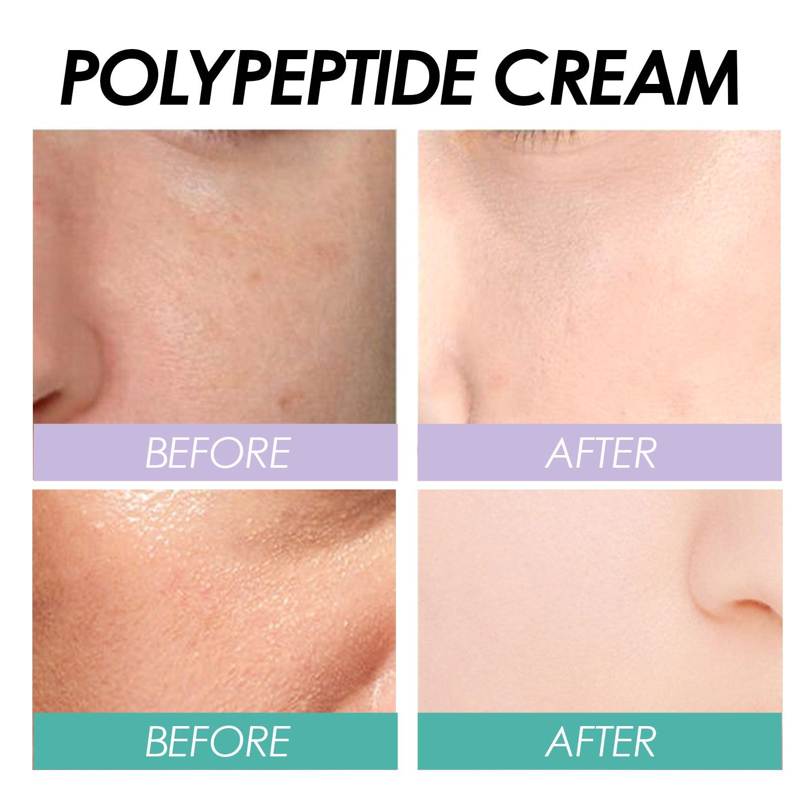 EELHOE cream before and after results
