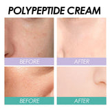 EELHOE cream before and after results