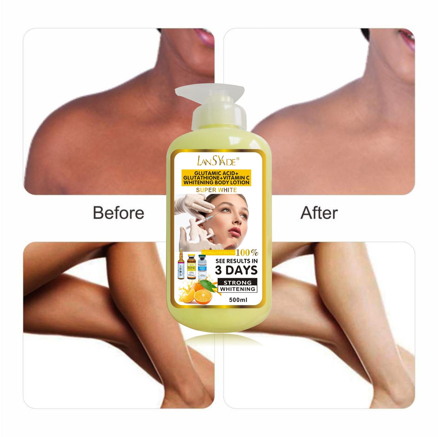 Before and after using VC Glutathione Lotion