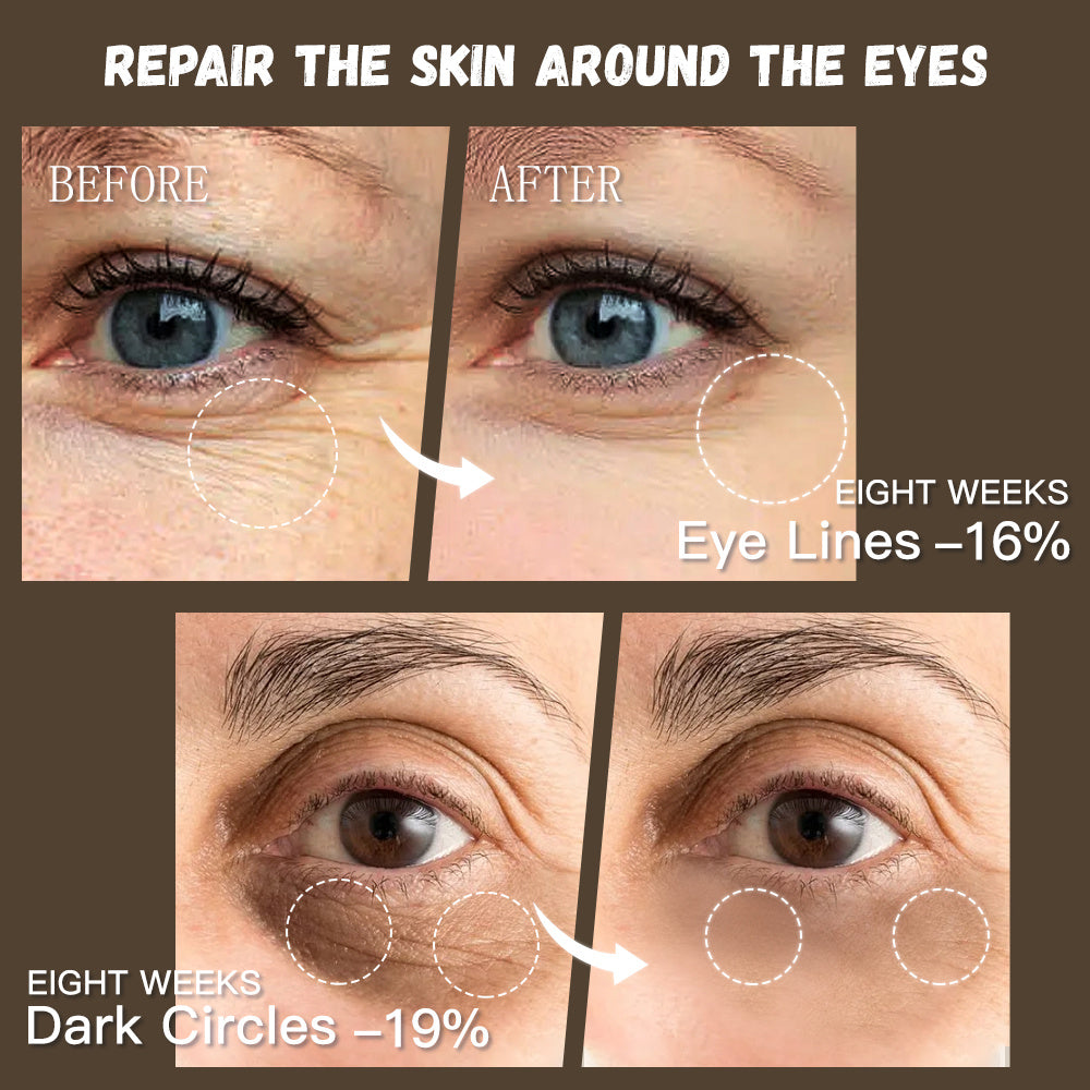 Organic eye cream with retinol