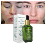 BREYLEE face serum on clean skin