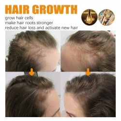 Biotin hair growth serum alternative