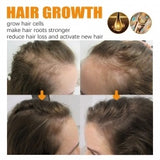 Biotin hair growth serum alternative
