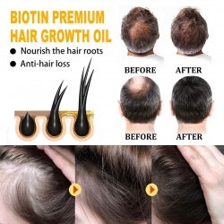 Strengthen hair follicles with biotin